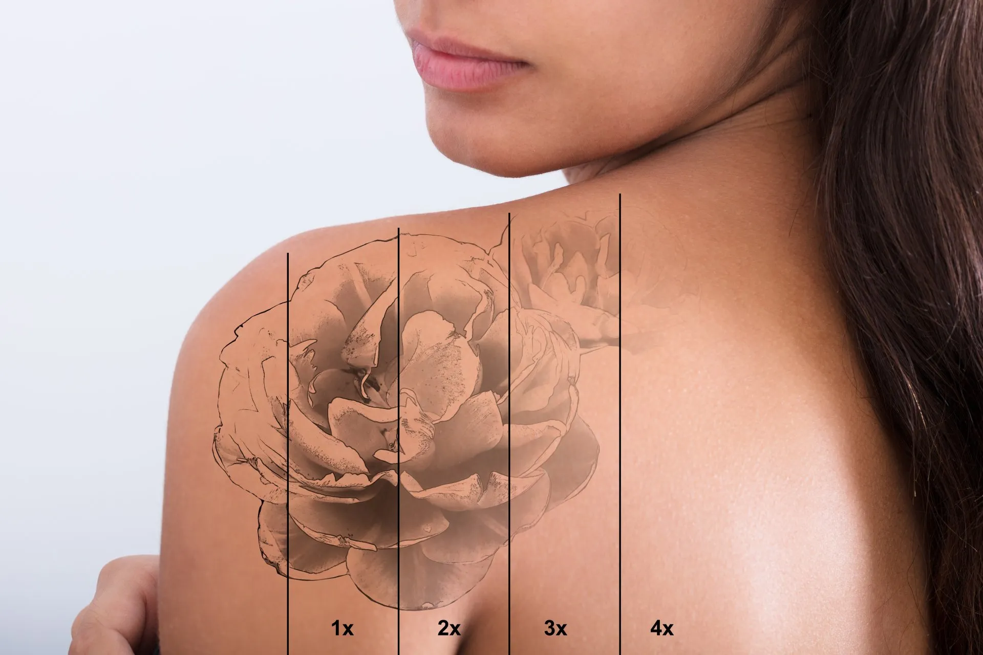 Woman with large rose tattoo on shoulder - Laser Tattoo Removal - Laser treatments & microneedling - Skinsolutions Wellness & Aesthetics - Medspa Hendersonville, TN