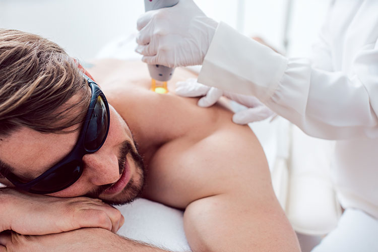 Laser Hair Removal for men and women - Laser treatments & microneedling - Skinsolutions Wellness & Aesthetics - Medspa Hendersonville, TN