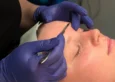 Aesthetician performing laser tattoo removal treatment at a med spa in Hendersonville, TN