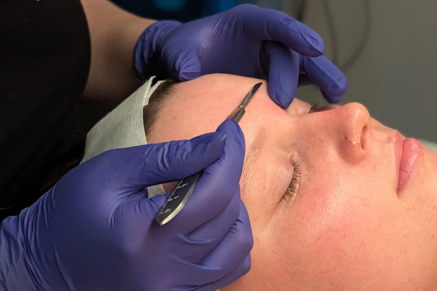 Aesthetician performing laser tattoo removal treatment at a med spa in Hendersonville, TN
